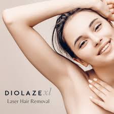 Diolaze Laser Hair Removal (Underarms) Series of 6 Treatments - Save $96