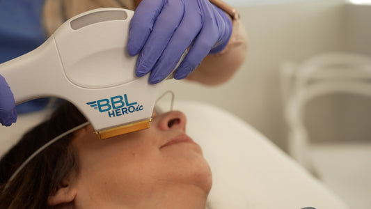 BBL HEROic 3 Treatments  (Face, Neck & Chest) - Treats Brown Spots, Sun Damage & Redness - Save $832.50