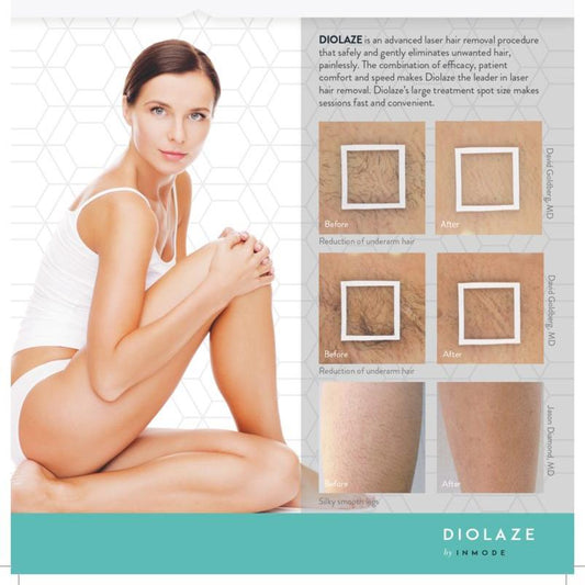 Diolaze Laser Hair Removal (Bikini)  Series of 6 Treatments - Save $180