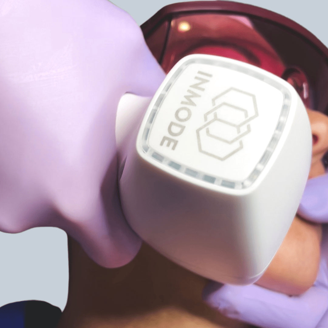 Diolaze Laser Hair Removal (Lip) - Series of 6 Treatments - Save $108