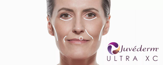 Juvederm Ultra